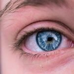 Are Eye Styes Contagious