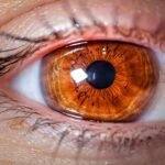 Iron Deficiency in Eye