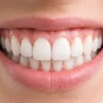 Healthy Teeth