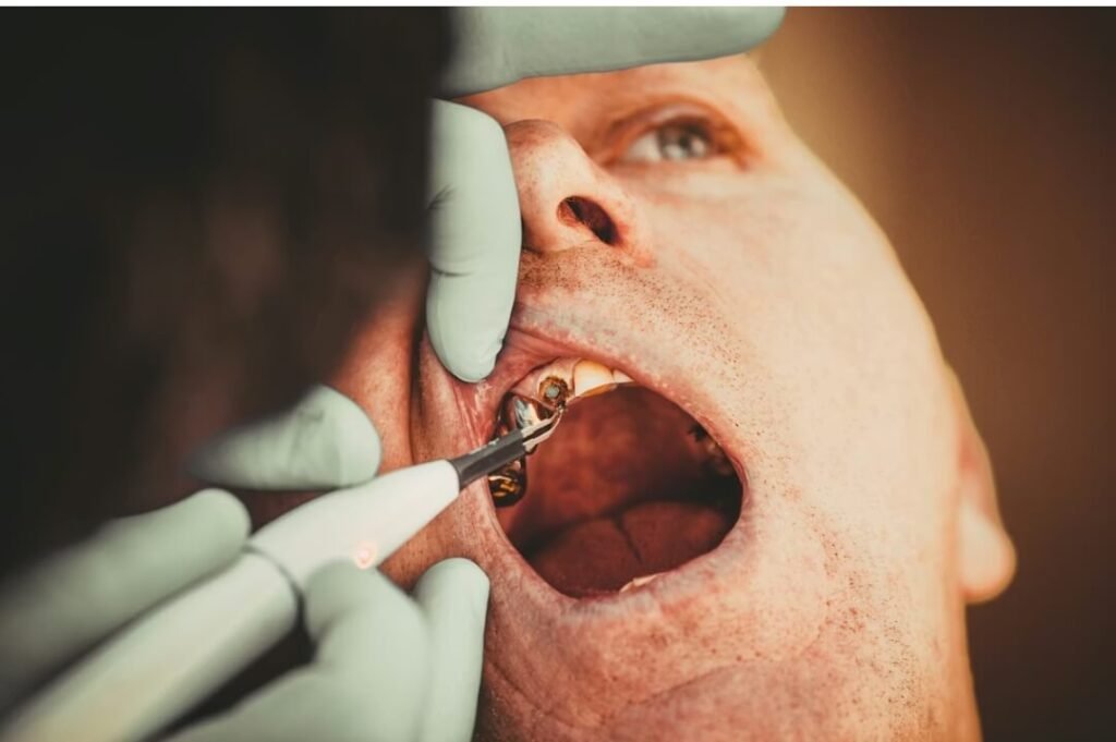 Guided Tissue Regeneration