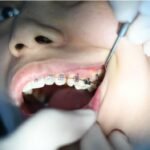 Orthodontists Near Me