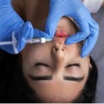 Botox Near Me