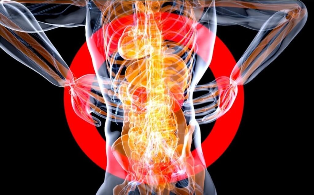 How to Treat Hemorrhoids