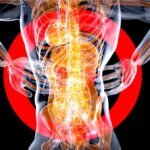 How to Treat Hemorrhoids
