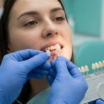 Porcelain Veneers