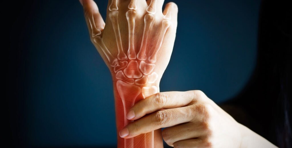 Bone Health