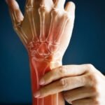 Bone Health